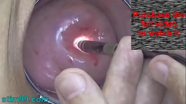 Hot Endoscope Camera inside Cervix Cam into Pussy Uterus fine Movies