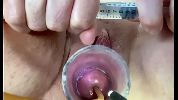Hot Extreme w inflation of catheter balloon in cervix fine Movies