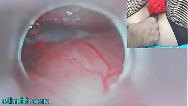 Hot Uncensored Japanese Insemination with Cum into Uterus and Endoscope Camera by Cervix to watch inside womb fine Movies